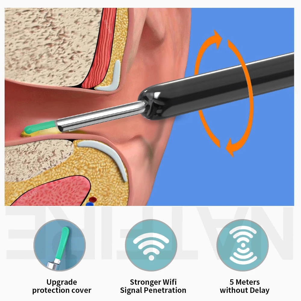 Safe Visual Ear Wax Removal Tool