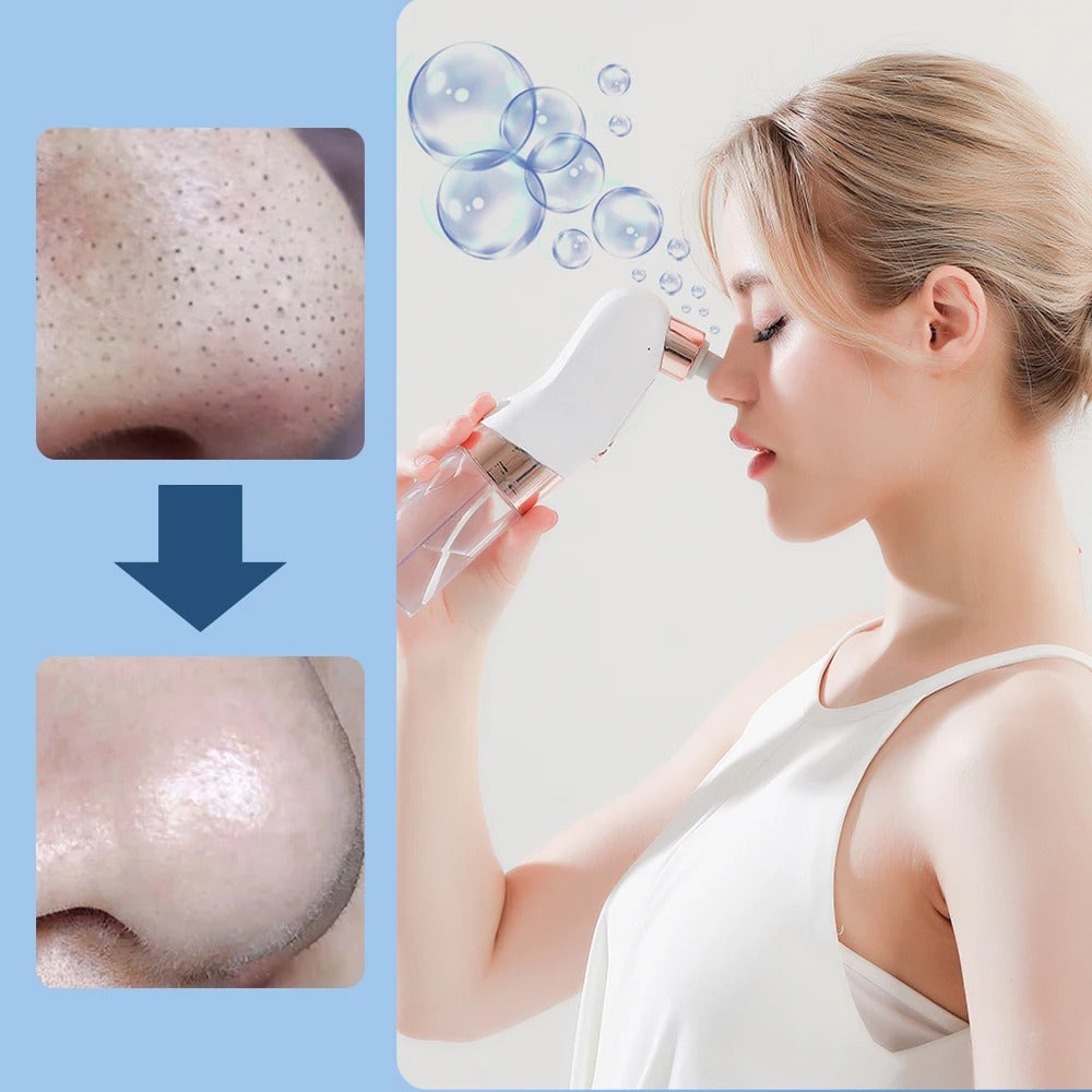 Electric Blackhead Remover: Clear Skin Solution